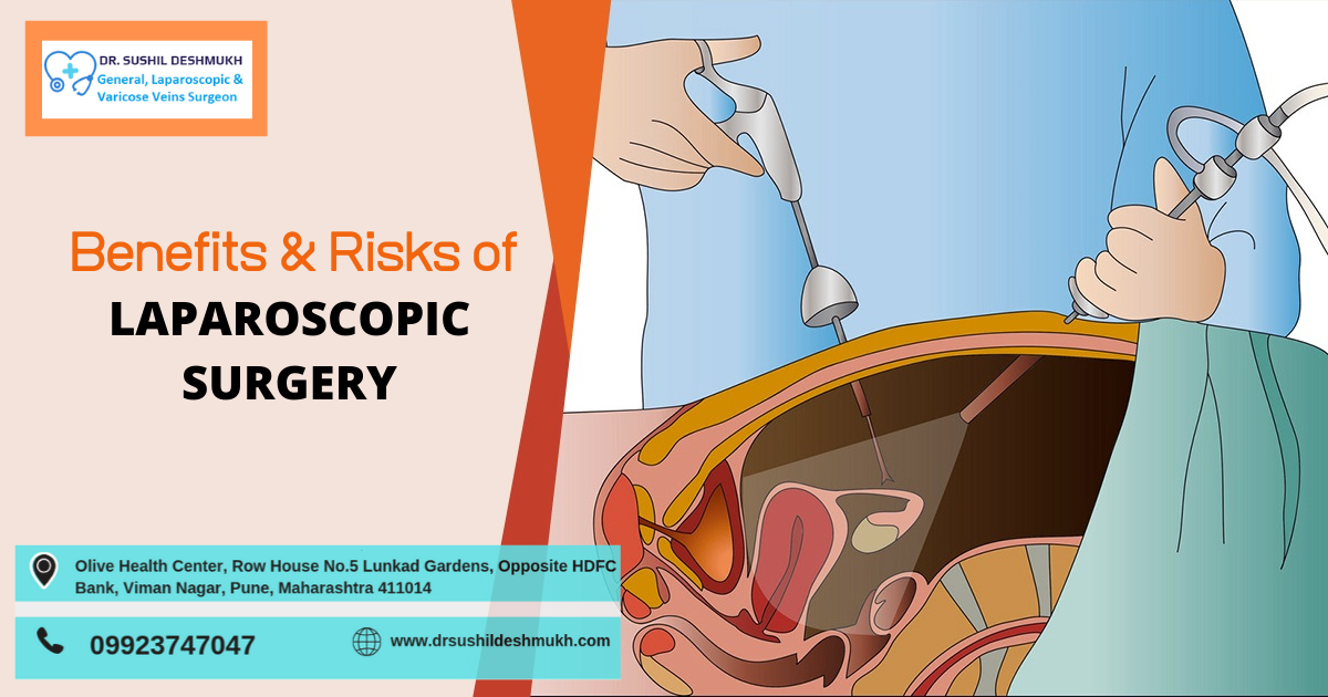 laparoscopic surgery in Pune, PCMC and India