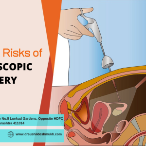 laparoscopy treatment in pune