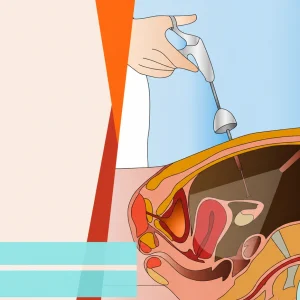 best doctor for laparoscopy treatment in pune